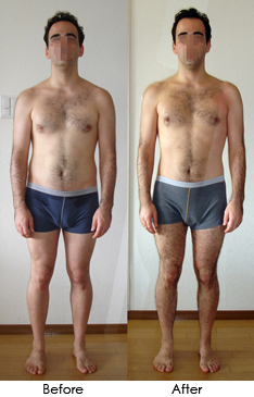 Before and after comparison of a client's posture