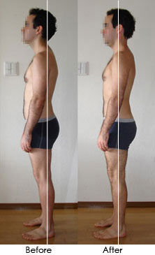 Before and after comparison of a client's posture