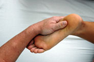 Rolfing before and after posture, example 3
